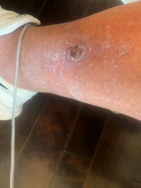 Jeep Gladiator Jeep Leg Slayers leg1
